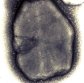 cristal bacillus thuringiensis